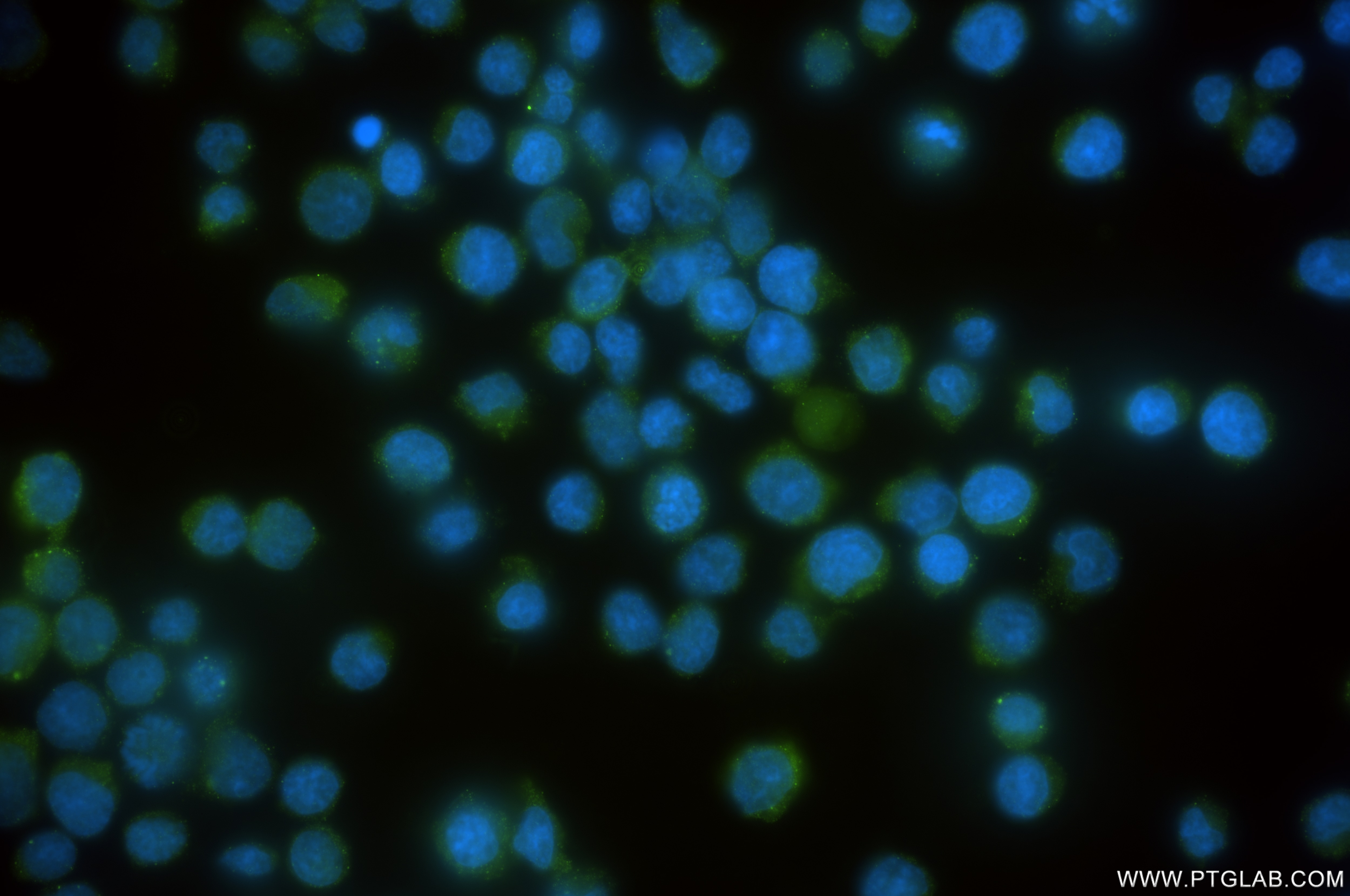 Immunofluorescence (IF) / fluorescent staining of Jurkat cells using DTX3L Recombinant antibody (85340-2-RR)