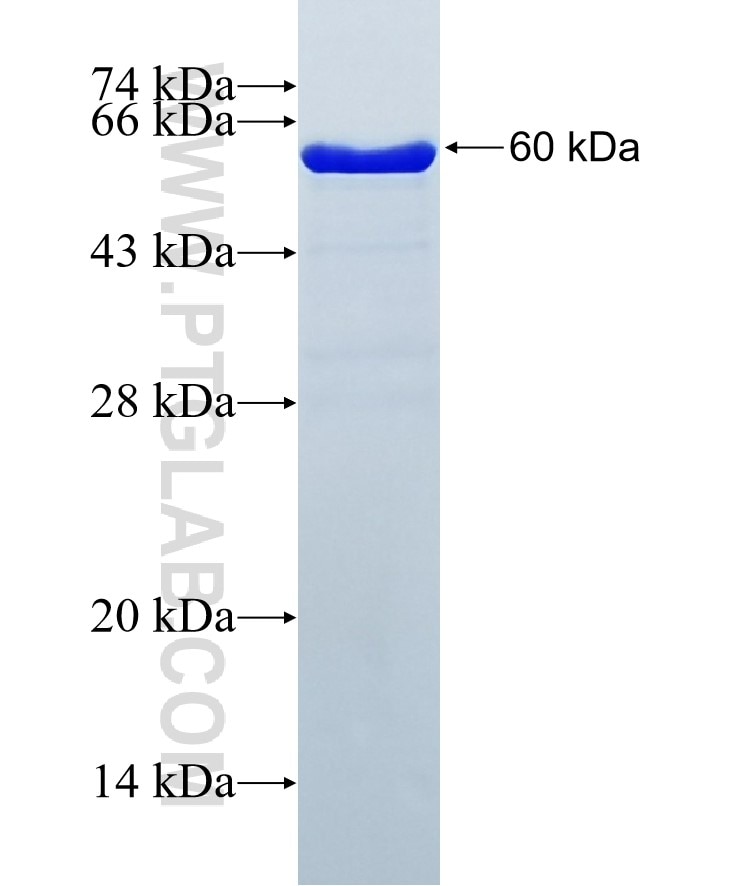 DTX3L fusion protein Ag2568 SDS-PAGE