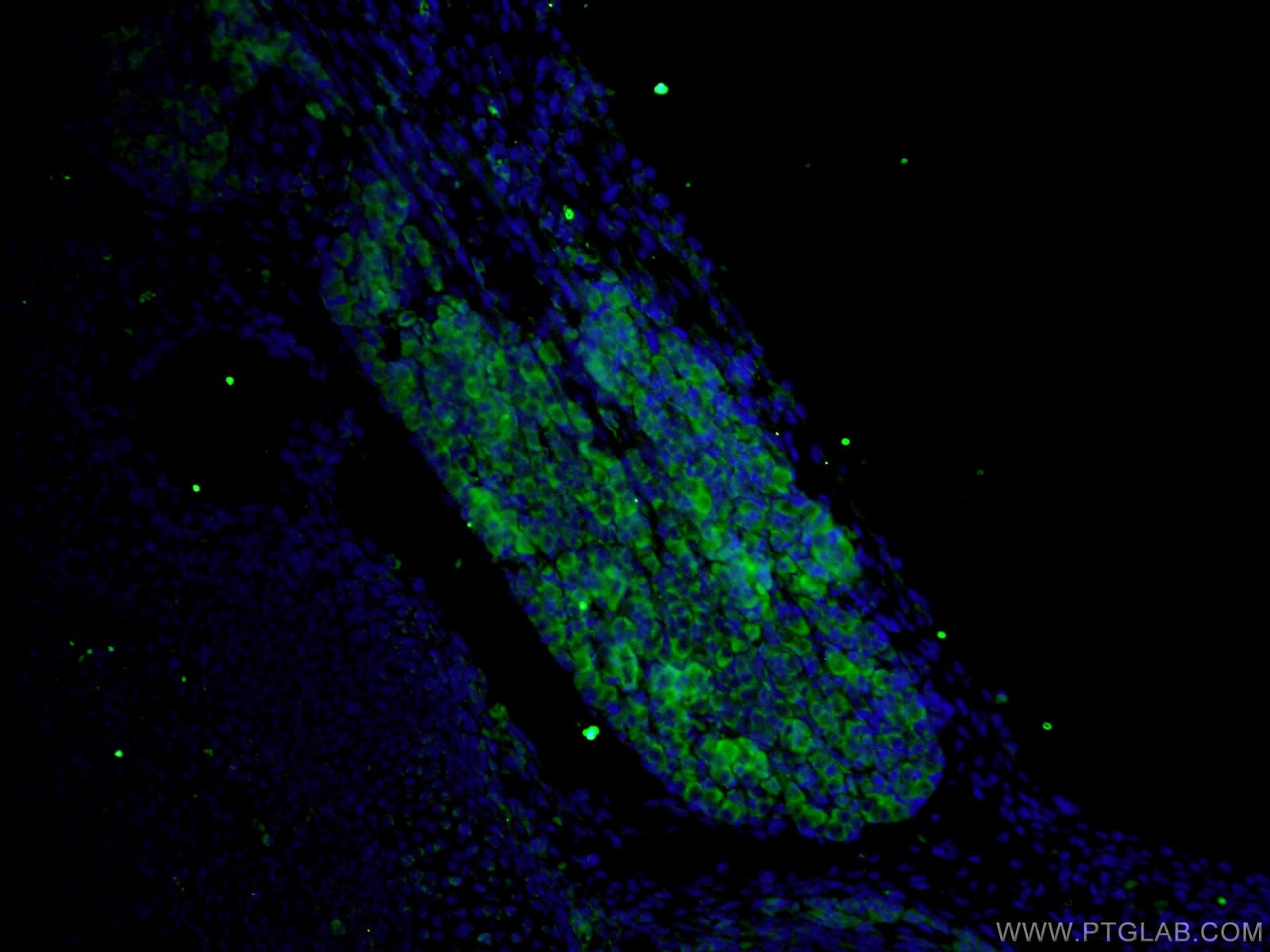 Immunofluorescence (IF) / fluorescent staining of mouse embryo tissue using DTX4 Polyclonal antibody (25222-1-AP)