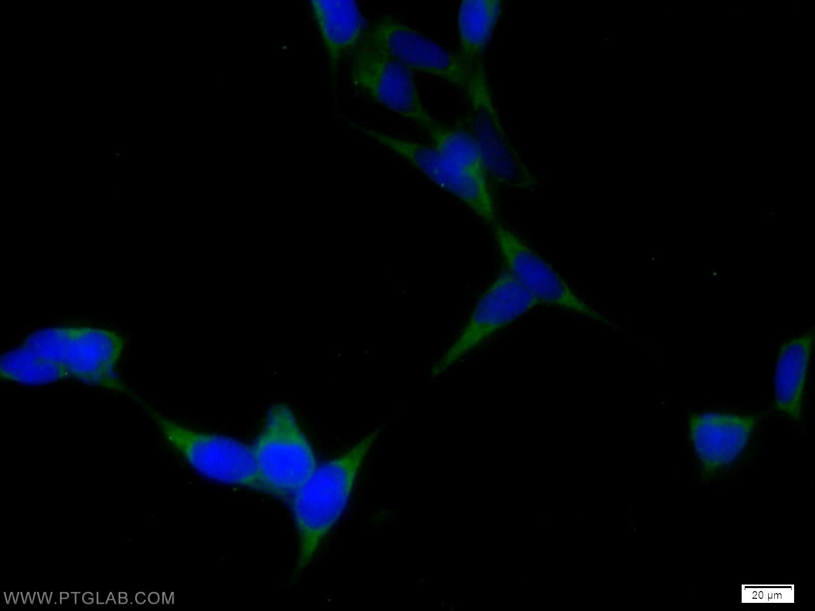 Immunofluorescence (IF) / fluorescent staining of HEK-293 cells using DTX4 Polyclonal antibody (25222-1-AP)