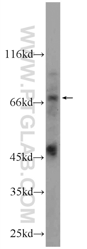 Western Blot (WB) analysis of mouse kidney tissue using DTX4 Polyclonal antibody (25222-1-AP)
