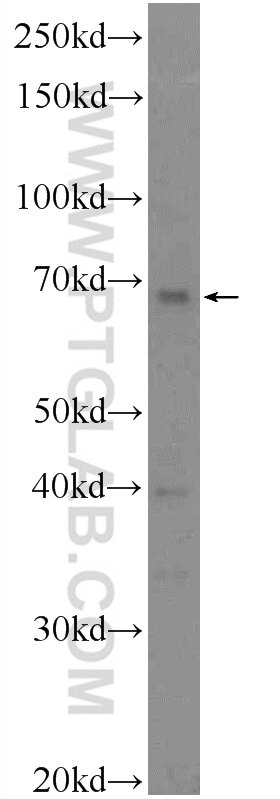 Western Blot (WB) analysis of mouse kidney tissue using DTX4 Polyclonal antibody (25222-1-AP)