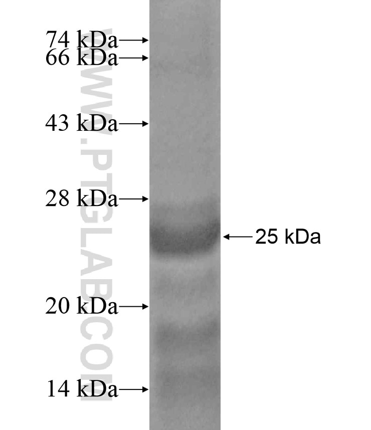 DTX4 fusion protein Ag18415 SDS-PAGE