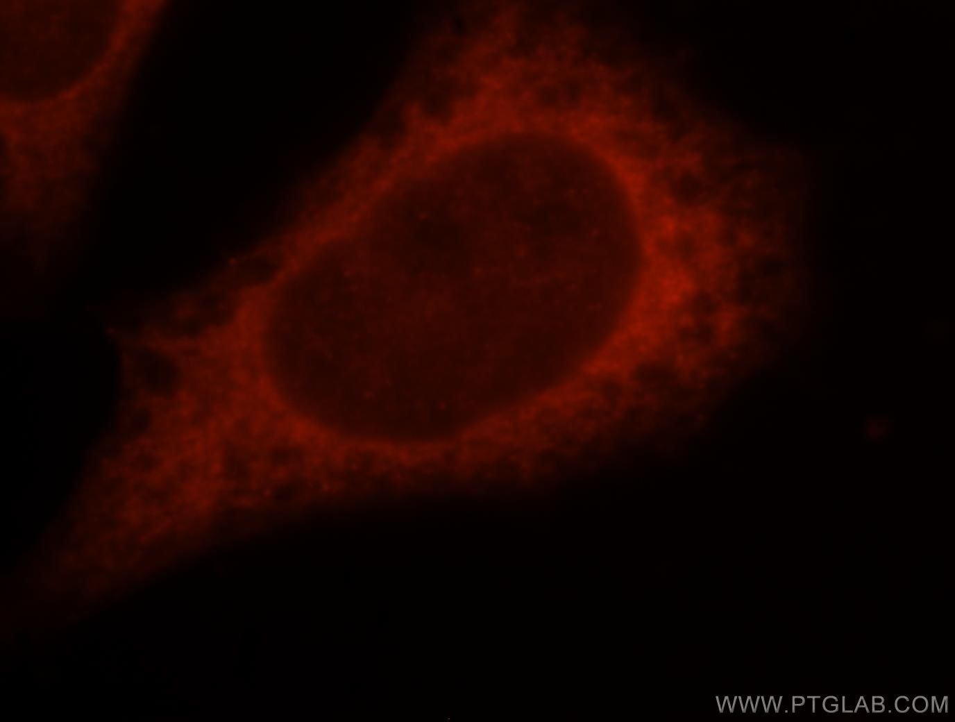 Immunofluorescence (IF) / fluorescent staining of MCF-7 cells using DTYMK Polyclonal antibody (15360-1-AP)