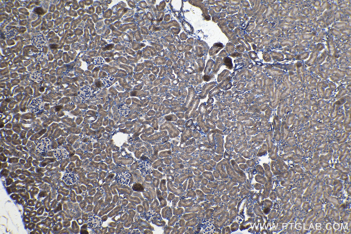 Immunohistochemistry (IHC) staining of mouse kidney tissue using DTYMK Polyclonal antibody (15360-1-AP)