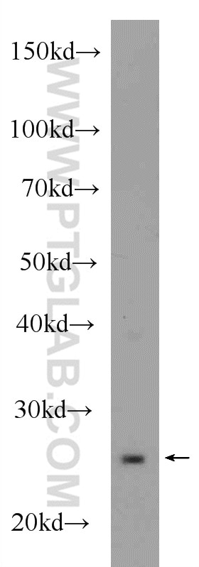 Western Blot (WB) analysis of mouse brain tissue using DTYMK Polyclonal antibody (15360-1-AP)