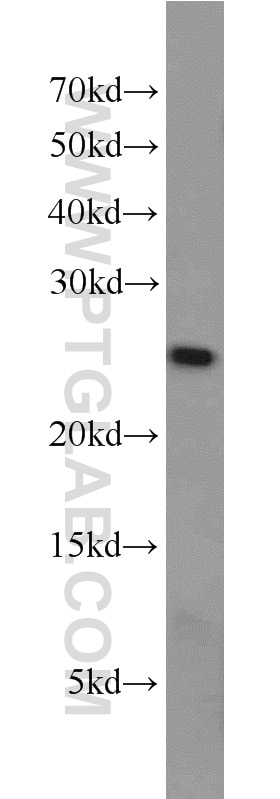 Western Blot (WB) analysis of HepG2 cells using DTYMK Polyclonal antibody (15360-1-AP)