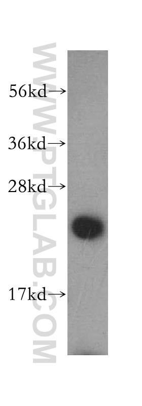 Western Blot (WB) analysis of HeLa cells using DTYMK Polyclonal antibody (15360-1-AP)