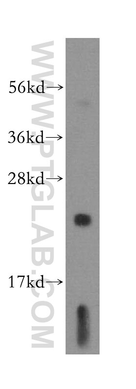 Western Blot (WB) analysis of human brain tissue using DTYMK Polyclonal antibody (15360-1-AP)