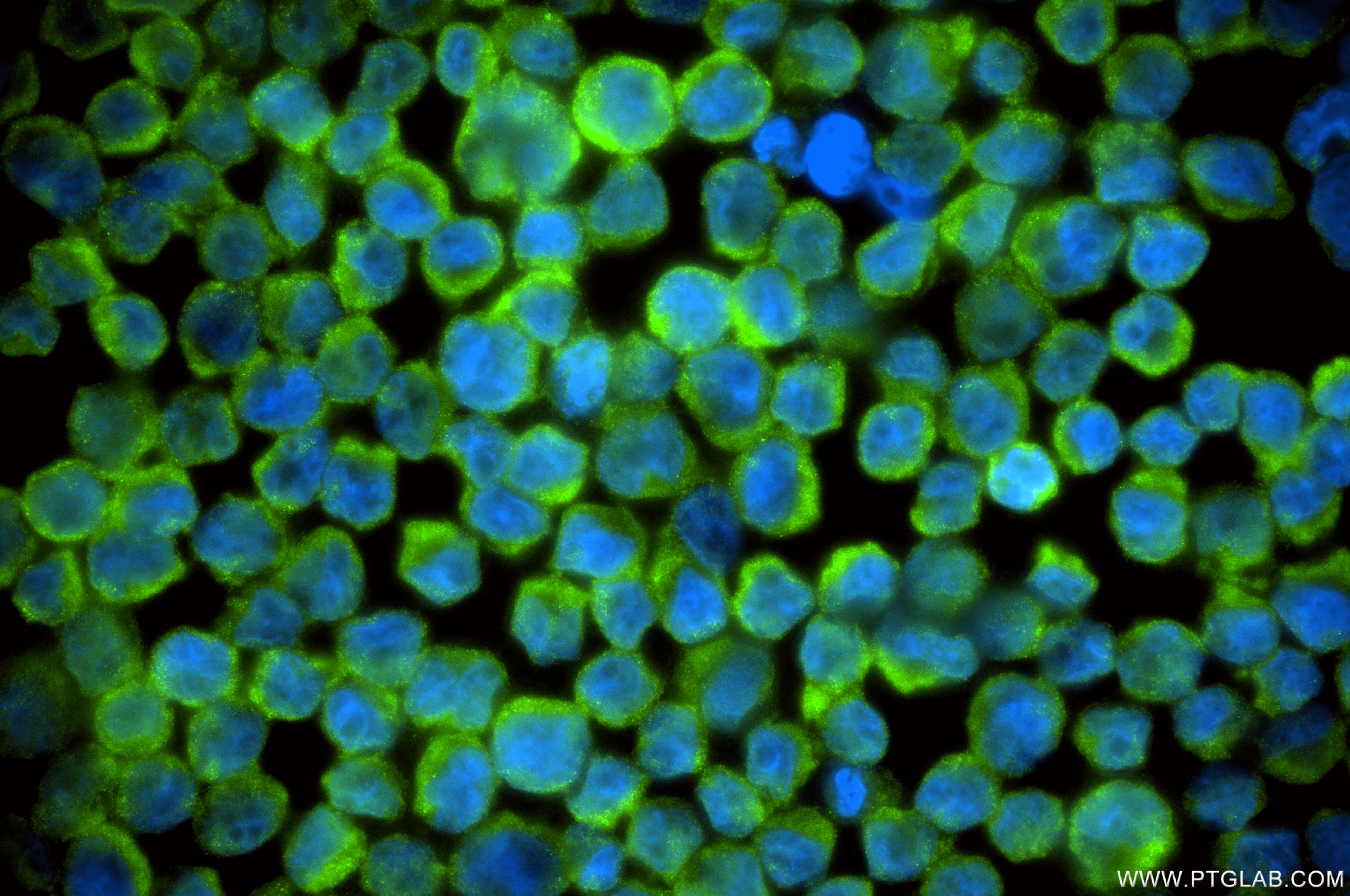 Immunofluorescence (IF) / fluorescent staining of Raji cells using DTYMK Recombinant monoclonal antibody (86543-3-RR)
