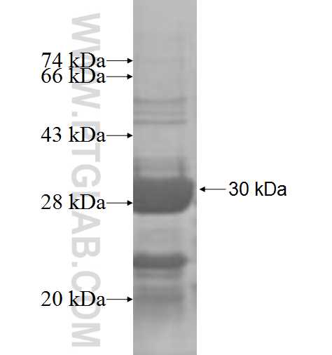 DTYMK fusion protein Ag7502 SDS-PAGE DTYMK fusion protein Ag7502 SDS-PAGE