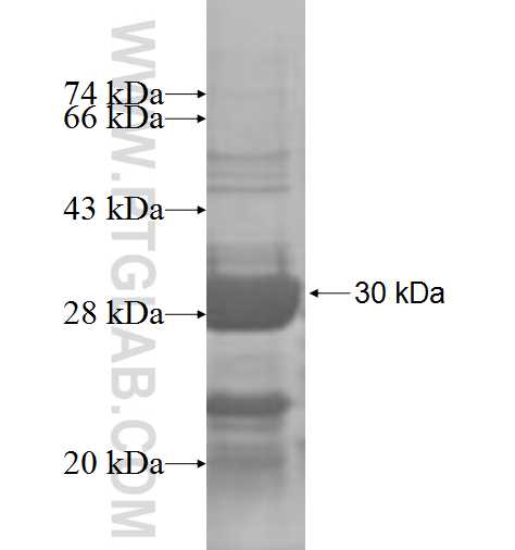 DTYMK fusion protein Ag7502 SDS-PAGE