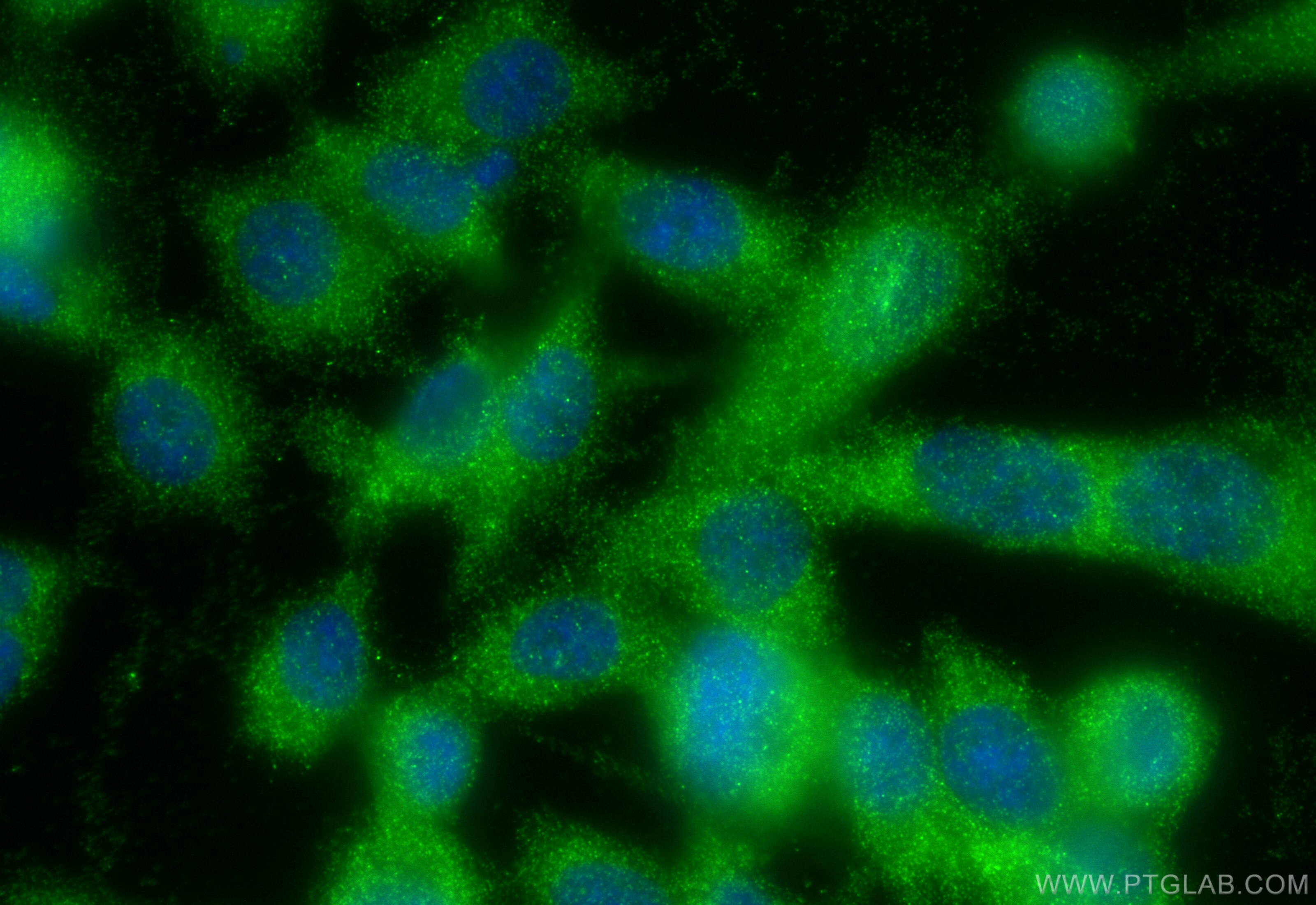 Immunofluorescence (IF) / fluorescent staining of PC-3 cells using DULLARD Polyclonal antibody (22088-1-AP)
