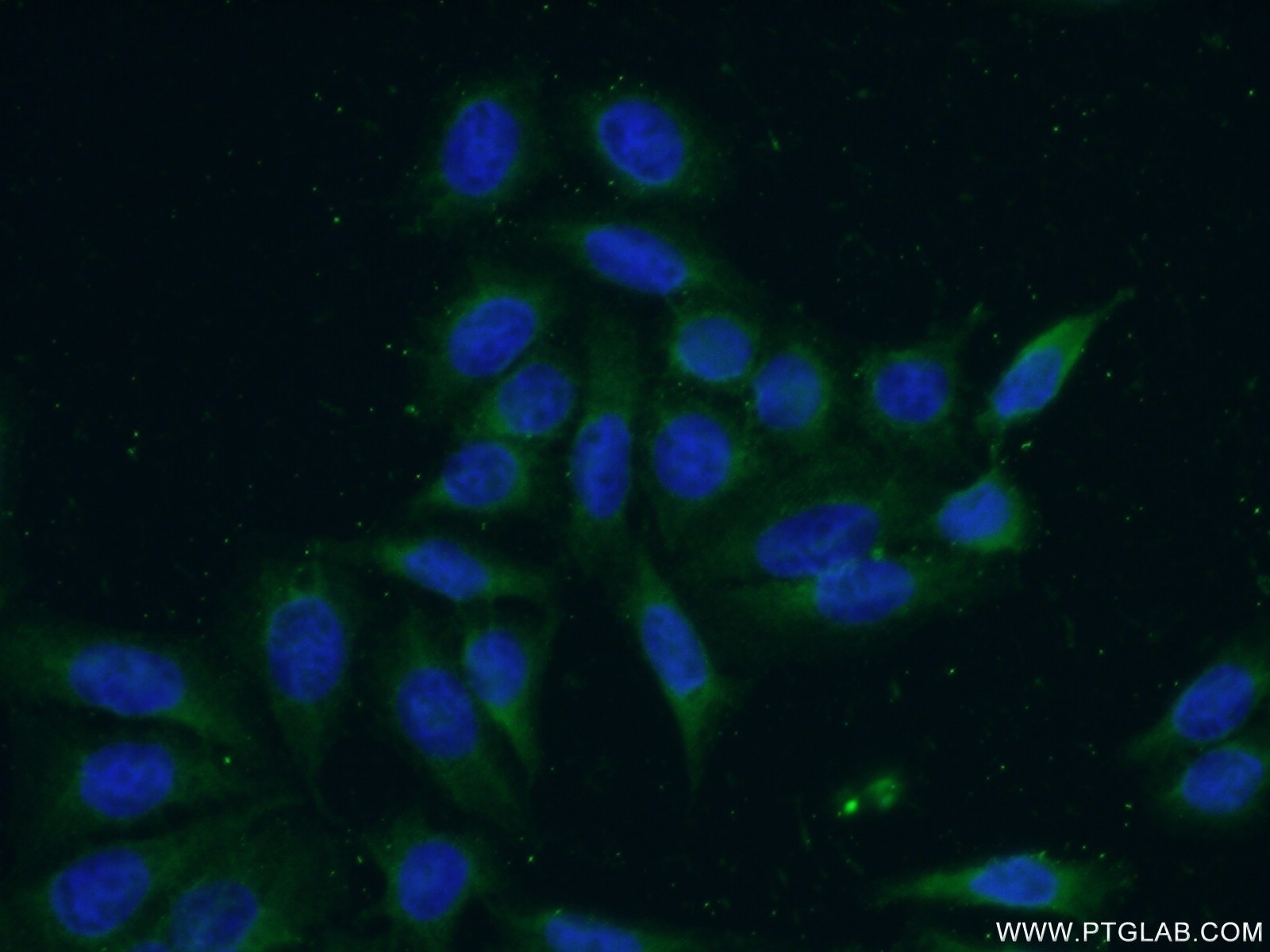 Immunofluorescence (IF) / fluorescent staining of PC-3 cells using DULLARD Polyclonal antibody (22088-1-AP)