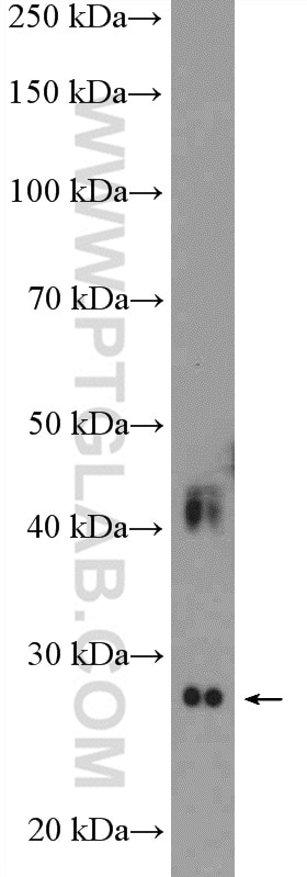 Western Blot (WB) analysis of mouse skeletal muscle tissue using DULLARD Polyclonal antibody (22088-1-AP)