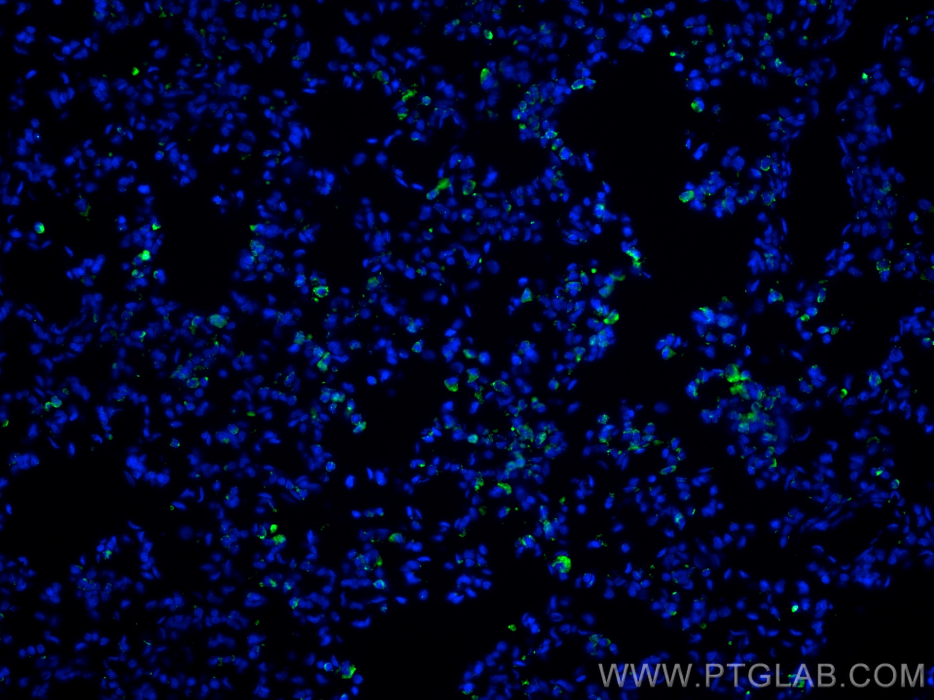 Immunofluorescence (IF) / fluorescent staining of rat lung tissue using DUOX1 Monoclonal antibody (67226-1-Ig)