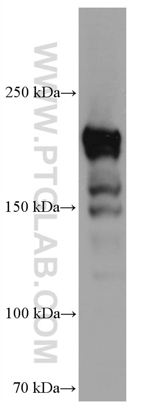 Western Blot (WB) analysis of human testis tissue using DUOX1 Monoclonal antibody (67226-1-Ig)