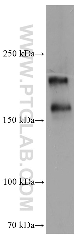 Western Blot (WB) analysis of human placenta tissue using DUOX1 Monoclonal antibody (67226-1-Ig)