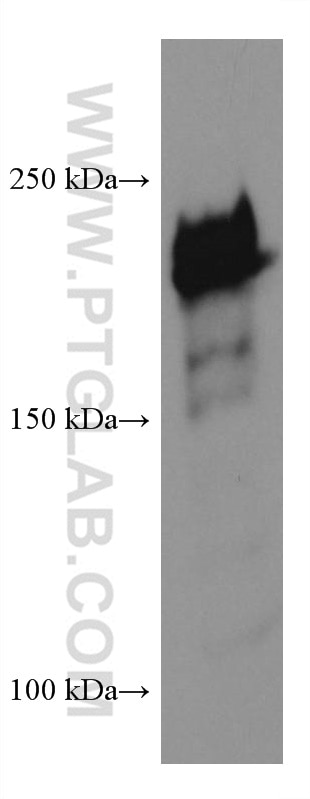 Western Blot (WB) analysis of human testis tissue using DUOX1 Monoclonal antibody (67226-1-Ig)