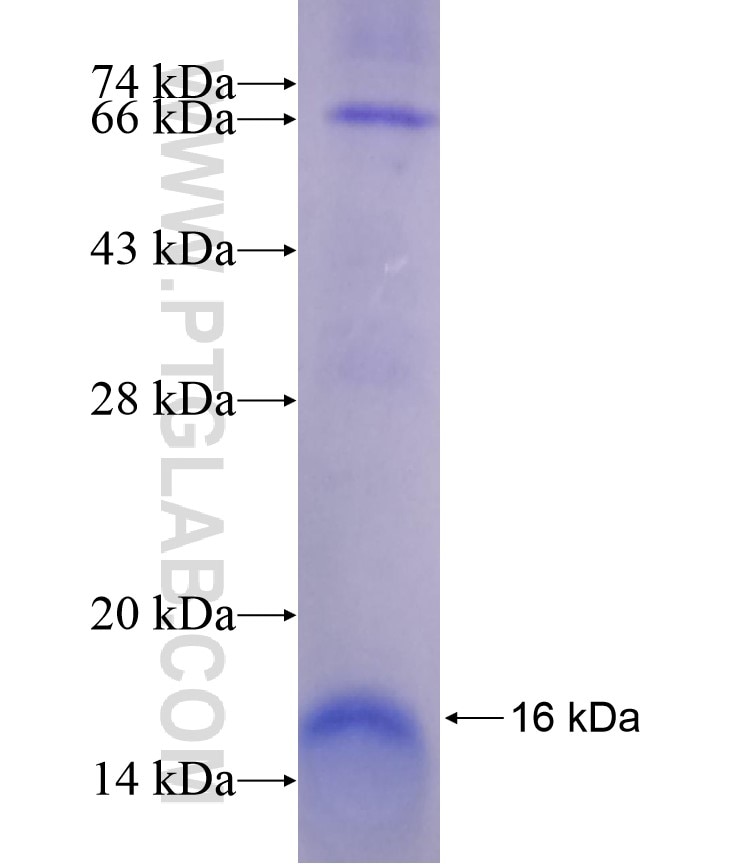 DUOX1 fusion protein Ag18154 SDS-PAGE