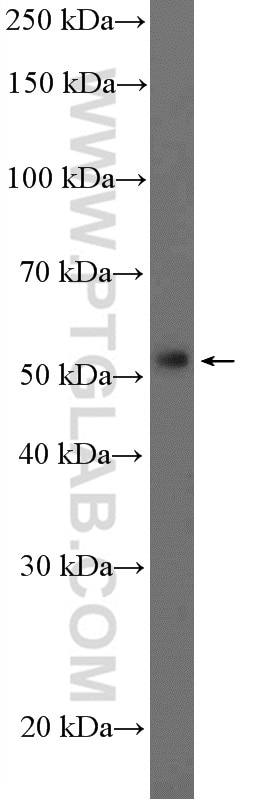 Western Blot (WB) analysis of Jurkat cells using DUOXA1 Polyclonal antibody (26632-1-AP)
