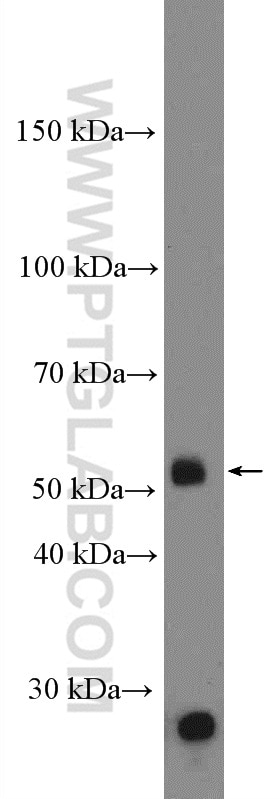 Western Blot (WB) analysis of mouse colon tissue using DUOXA1 Polyclonal antibody (26632-1-AP)
