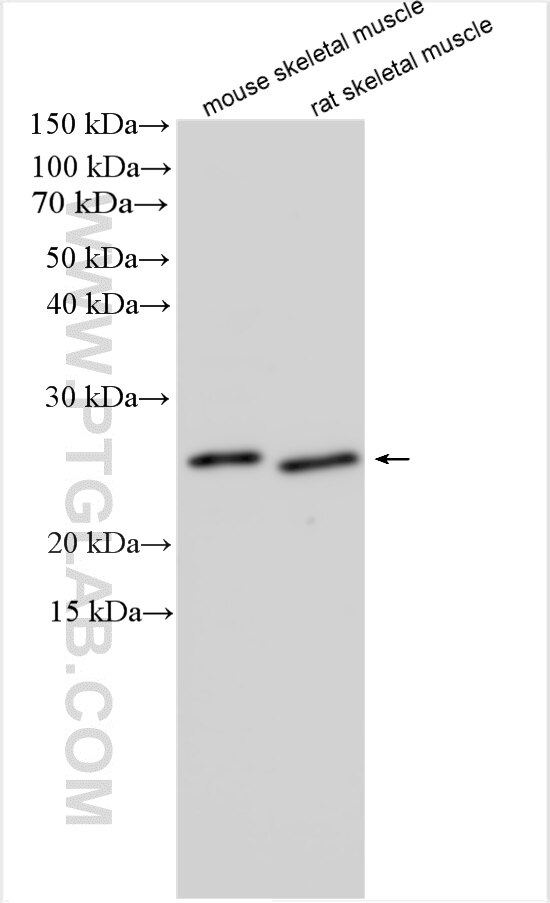 Western Blot (WB) analysis of various lysates using DUPD1 / DUSP27 Polyclonal antibody (25259-1-AP)
