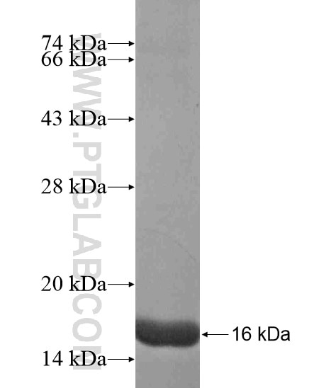 DUPD1 fusion protein Ag19658 SDS-PAGE