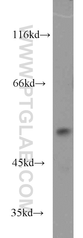 Western Blot (WB) analysis of Jurkat cells using DUS1L Polyclonal antibody (17253-1-AP)