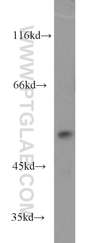 WB analysis of Jurkat using 17253-1-AP