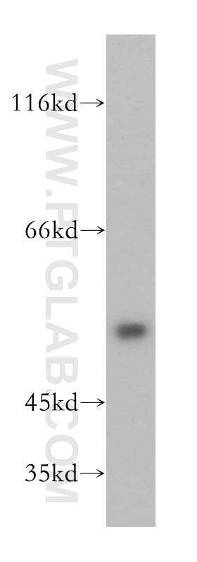 Western Blot (WB) analysis of Jurkat cells using DUS1L Polyclonal antibody (17253-1-AP)