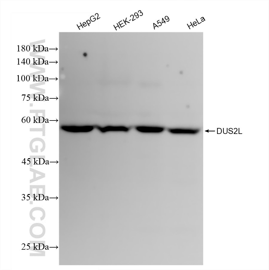 Western Blot (WB) analysis of various lysates using DUS2L Recombinant antibody (83265-7-RR)