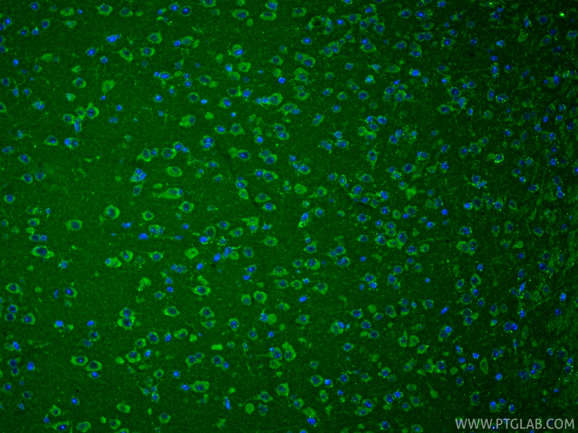 IF Staining of mouse brain using 83265-8-RR Immunofluorescence (IF) / fluorescent staining of mouse brain tissue using DUS2L Recombinant monoclonal antibody (83265-8-RR)