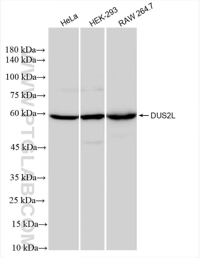 Western Blot (WB) analysis of various lysates using DUS2L Recombinant antibody (83265-8-RR)