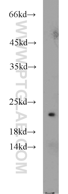 Western Blot (WB) analysis of mouse kidney tissue using DUS4L Polyclonal antibody (21870-1-AP)