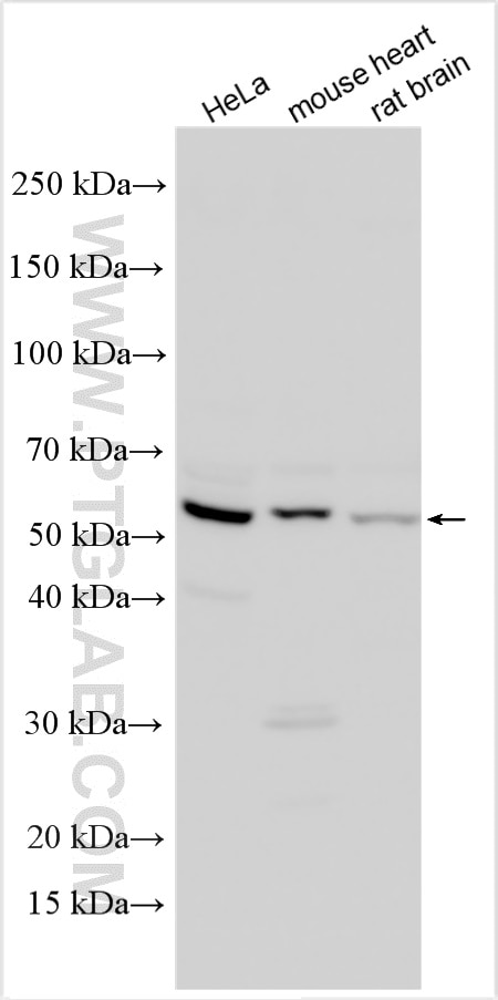 Western Blot (WB) analysis of various lysates using DUSP10 Polyclonal antibody (30493-1-AP)