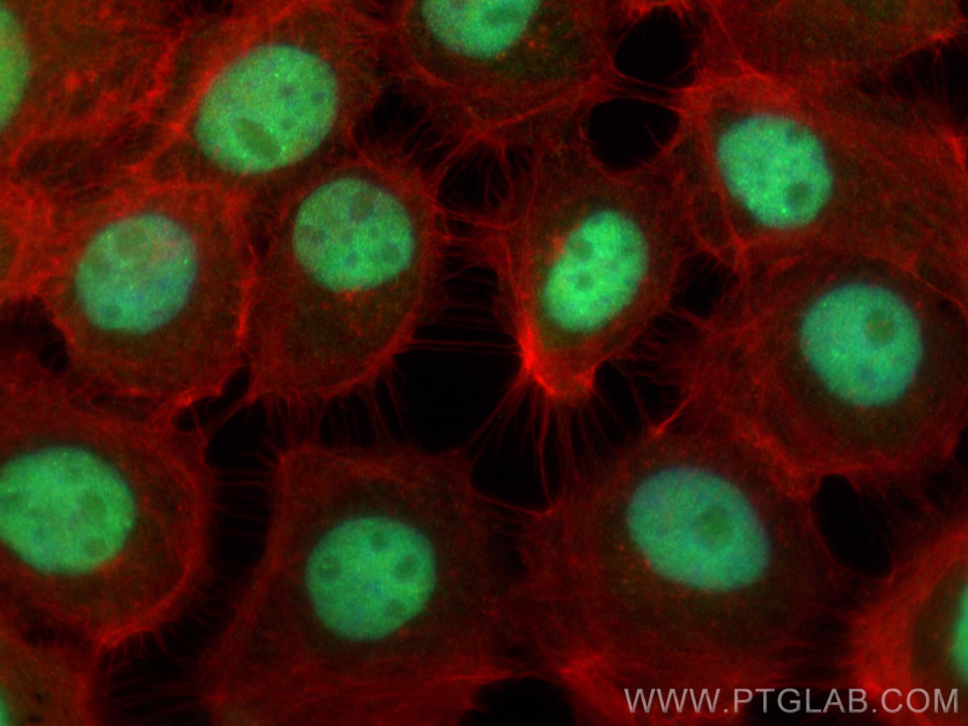 Immunofluorescence (IF) / fluorescent staining of A431 cells using DUSP11 Polyclonal antibody (10204-2-AP)