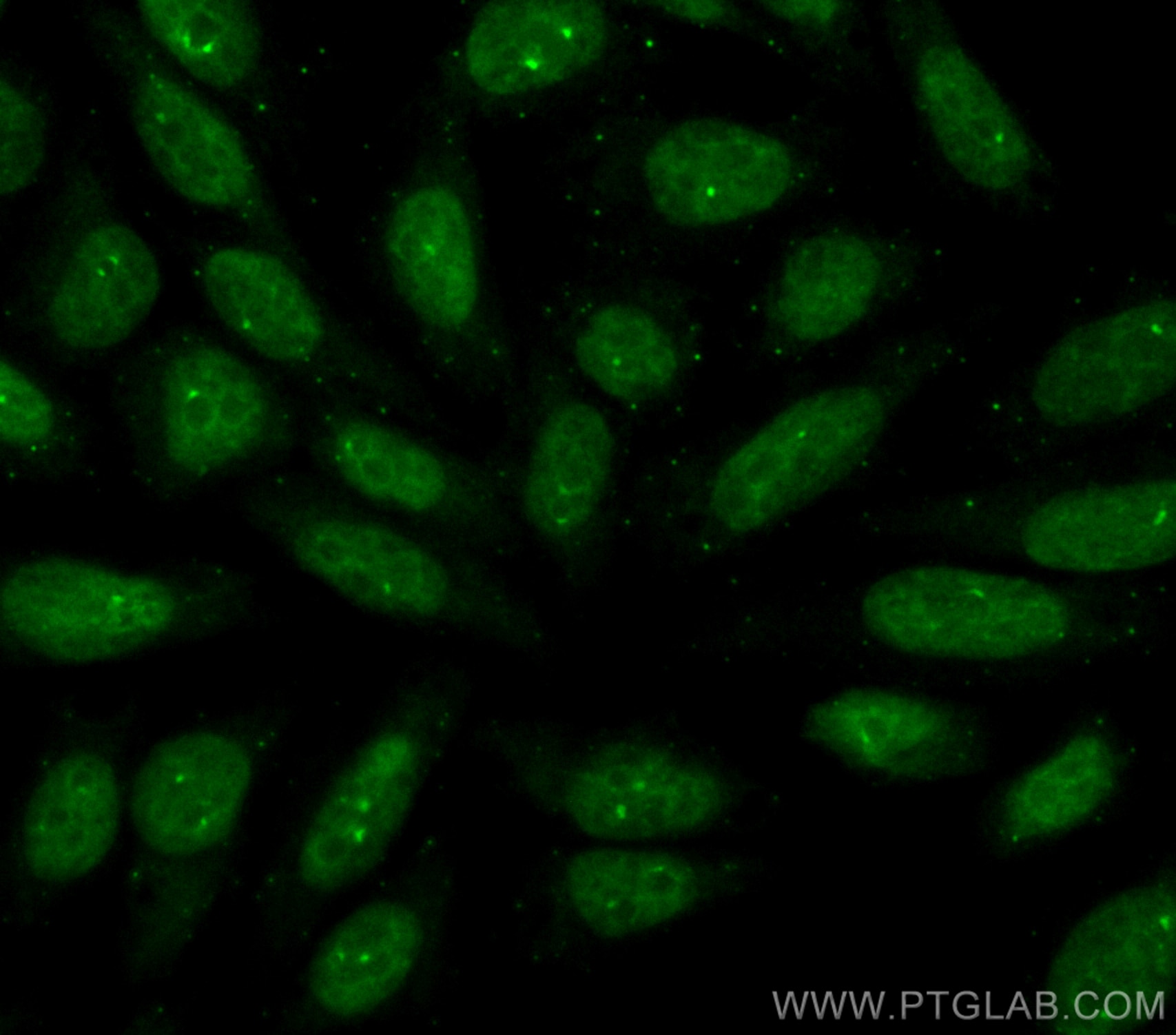 IF Staining of HepG2 using CL488-10204