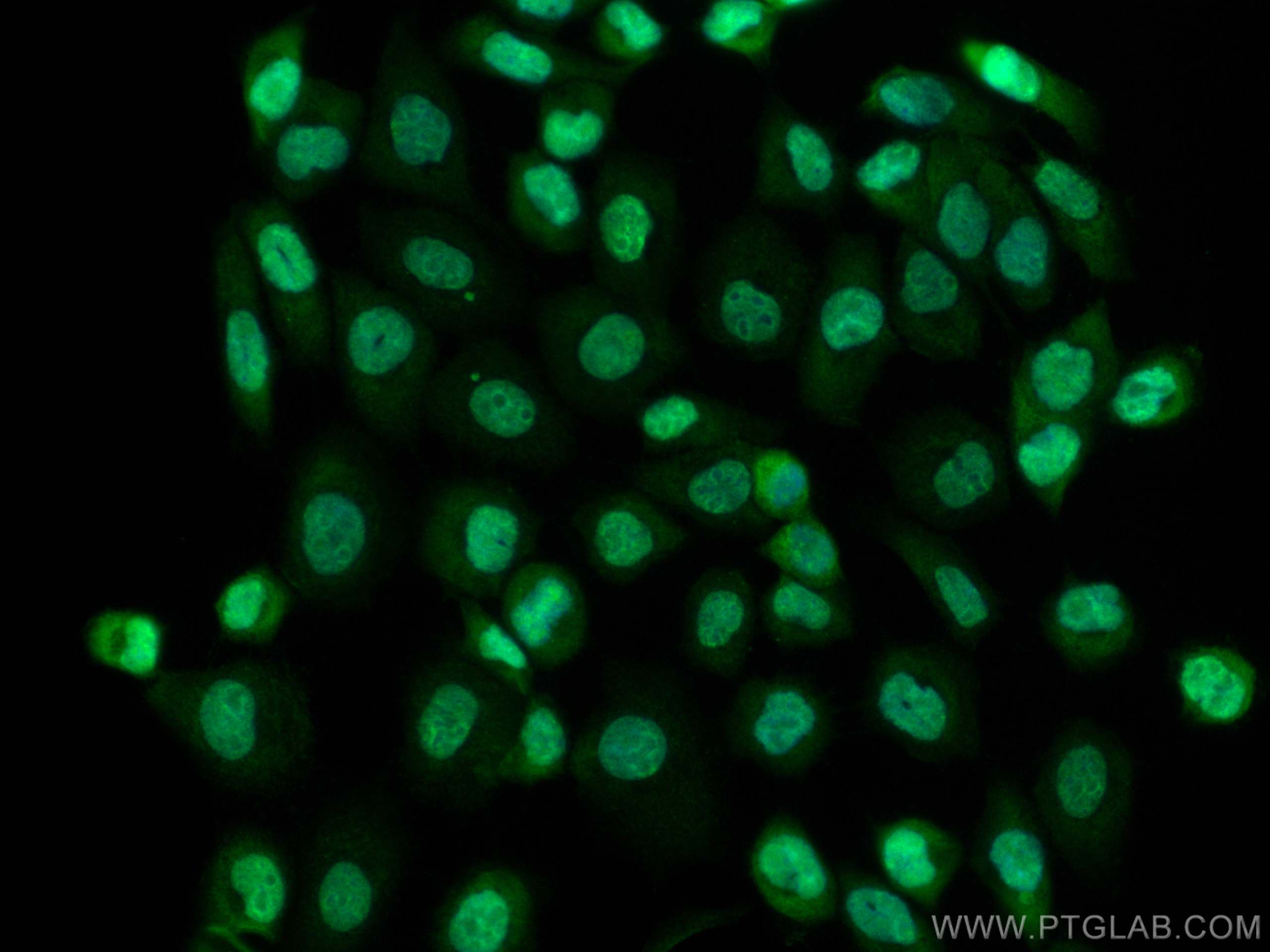 Immunofluorescence (IF) / fluorescent staining of A431 cells using CoraLite® Plus 488-conjugated DUSP11 Polyclonal an (CL488-10204)
