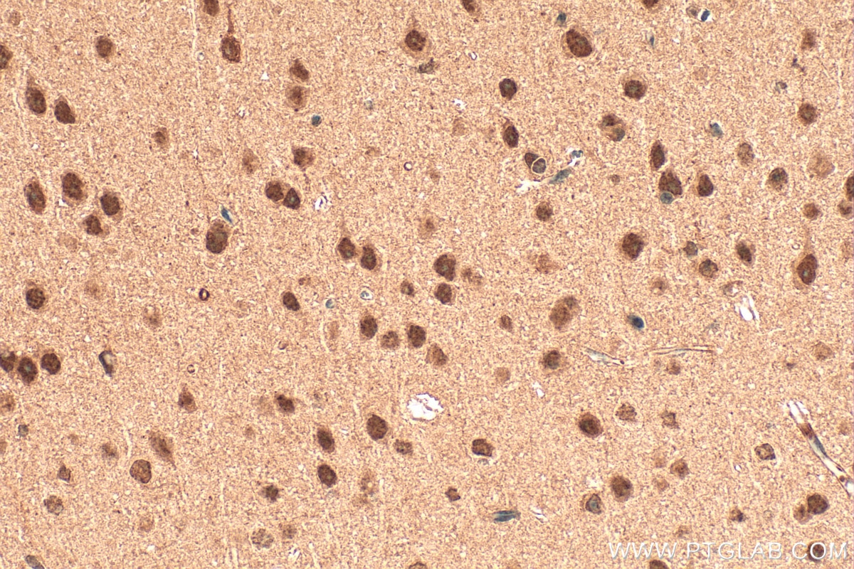 Immunohistochemistry (IHC) staining of mouse brain tissue using DUSP12 Polyclonal antibody (15667-1-AP)