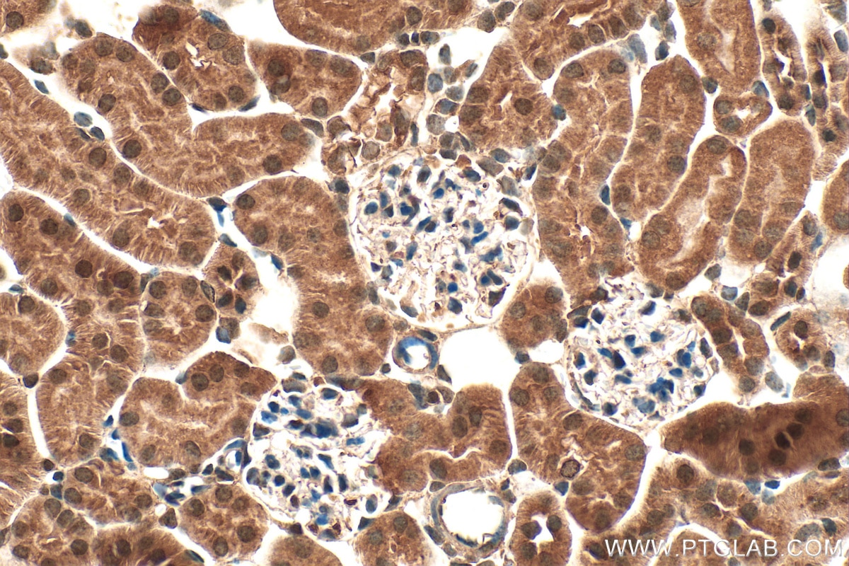 Immunohistochemistry (IHC) staining of mouse kidney tissue using DUSP12 Polyclonal antibody (15667-1-AP)