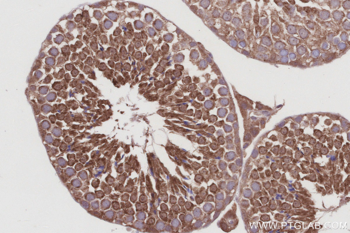 Immunohistochemistry (IHC) staining of mouse testis tissue using DUSP13 Polyclonal antibody (10909-1-AP)