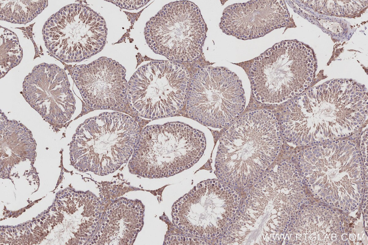 Immunohistochemistry (IHC) staining of rat testis tissue using DUSP13 Polyclonal antibody (10909-1-AP)