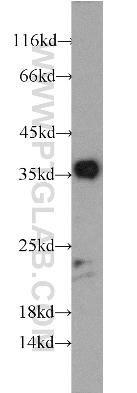 Western Blot (WB) analysis of human skeletal muscle tissue using DUSP13 Polyclonal antibody (10909-1-AP)