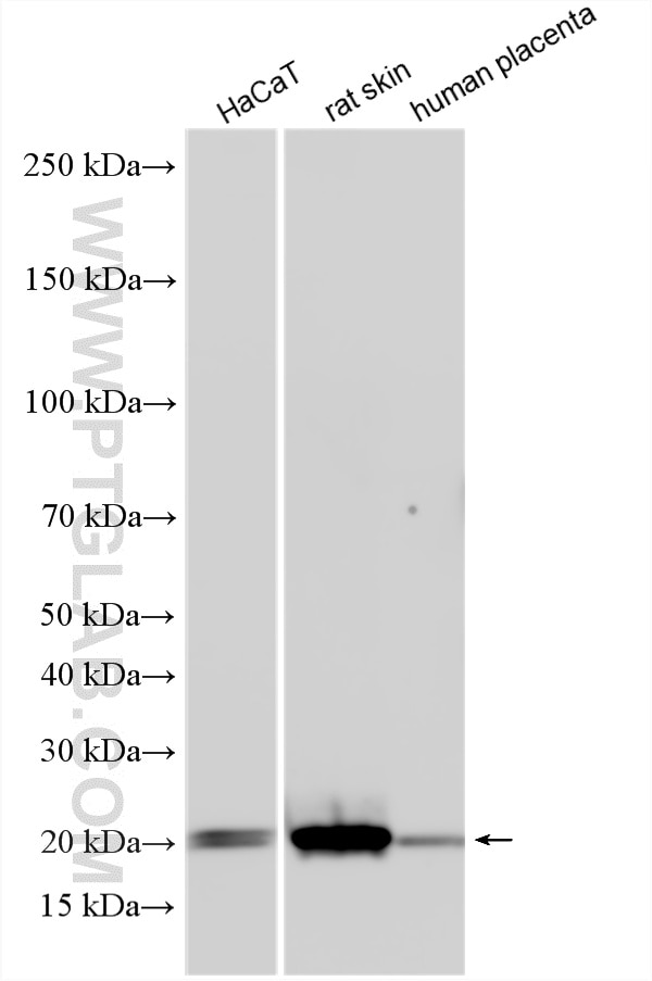 WB analysis using 10172-2-AP Western Blot (WB) analysis of various lysates using DUSP14 Polyclonal antibody (10172-2-AP)