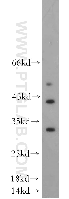 Western Blot (WB) analysis of A375 cells using DUSP15 Polyclonal antibody (14629-1-AP)