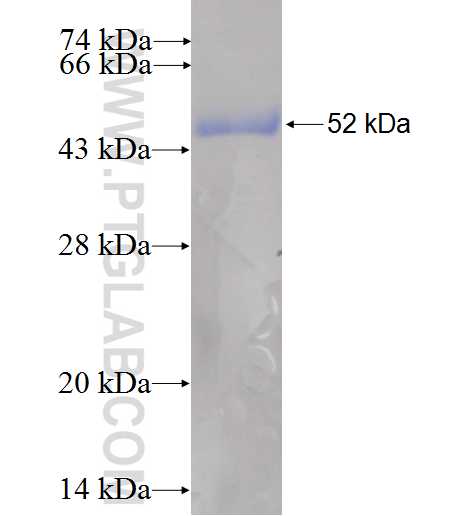 DUSP15 fusion protein Ag6204 SDS-PAGE
