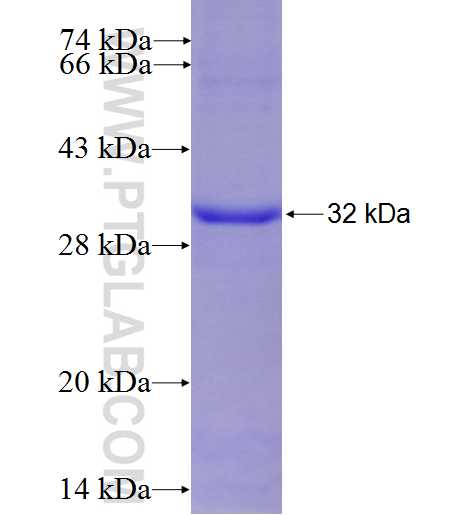 DUSP15 fusion protein Ag6308 SDS-PAGE