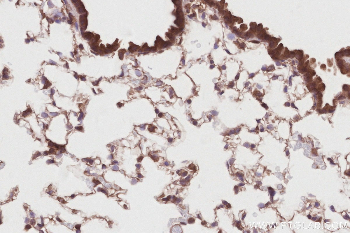 Immunohistochemistry (IHC) staining of mouse lung tissue using DUSP16 Polyclonal antibody (14237-1-AP)
