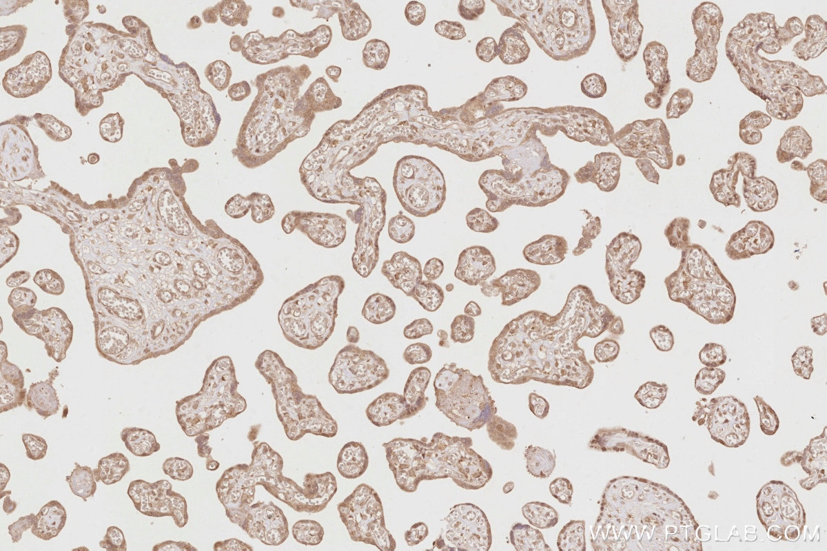 Immunohistochemistry (IHC) staining of human placenta tissue using DUSP16 Polyclonal antibody (14237-1-AP)
